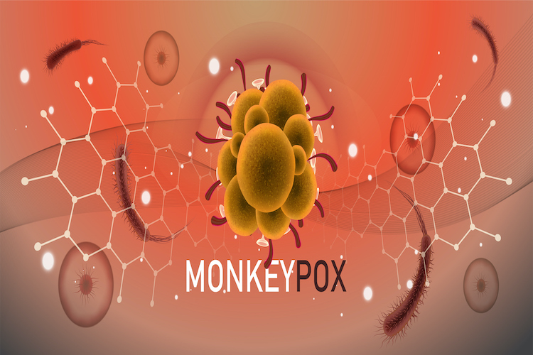 Q&A: What you need to know about monkeypox