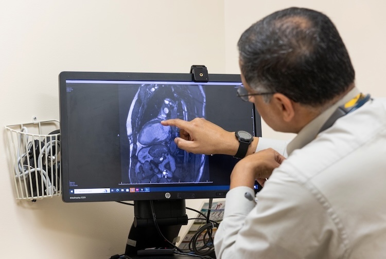 Aamer Syed looking at a scan of patient’s lungs on a computer