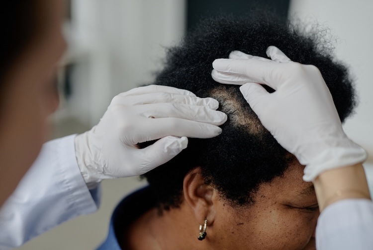 b12 injections for hair loss Shots & B12 Injections: The Good, Bad and Alternative! does b12 injections help hair