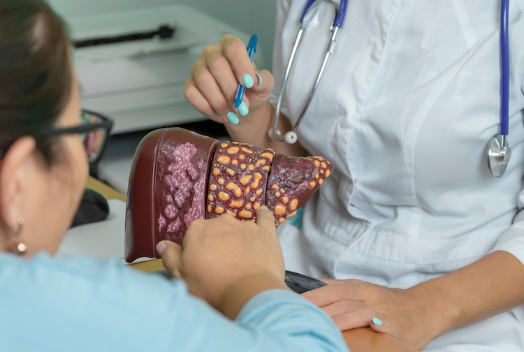 Doctor shows patient a replica of a liver.